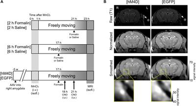 Primary Role of the Amygdala in Spontaneous Inflammatory Pain- Associated Activation of Pain Networks – A Chemogenetic Manganese-Enhanced MRI Approach